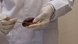 تشریح کلیه قسمت دوم