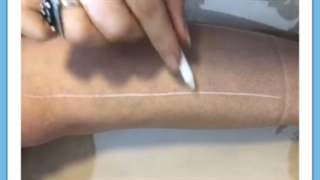 آیا لیزر بیکینی برای دختران عوارض دارد؟ شایعه نازایی و سرطان