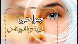 جراحی لیزیک و بلفاروپلاستی