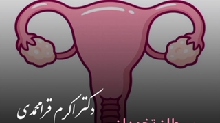 سرطان تخمدان