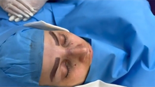 فیلم جراحی بینی