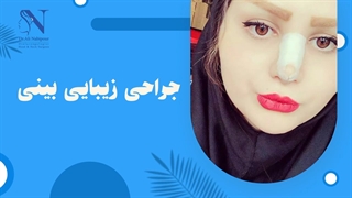 نتیجه عمل زیبایی بینی