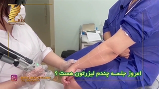 لیزر موهای زائد در مرکز لیزر نامعتبر