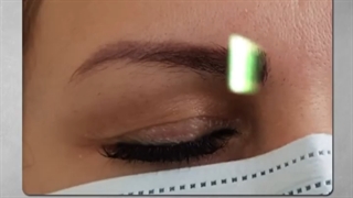 چهره طبیعی داشته باش با کاشت ابرو طبیعی