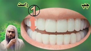 نحوه مسواک زدن سنتی