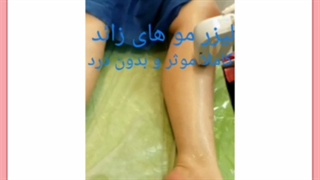 زمان دقیق ریزش موها بعد از لیزر