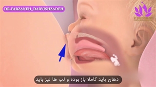 شیردهی غیر موثر و عوامل بروز آن در نوزاد ...