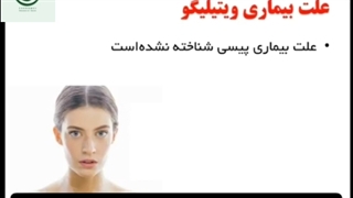 بیماری پوستی ویتیلیگو چیست؟ برص پیسی بهاق