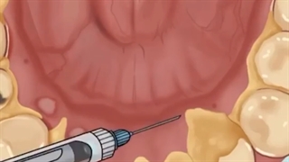 صفر تا 100 داشتن دندونهای تمیز و زیبا.متخصص ارتودنسی تهران دکترعلیرضا خدیوی