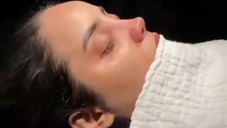 فیلم جراحی بینی طبیعی