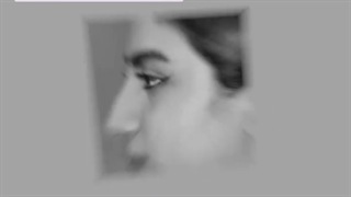 جراحی بینی نیمه فانتزی