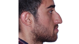 ارتودنسی و جراحی فک | دکتر داودیان