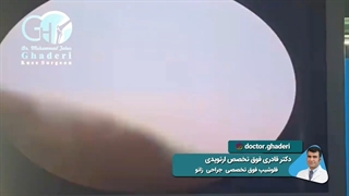 عوارض تزریق مفصلی