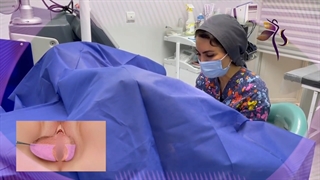 صحبتهای مریض حین عمل لابیاپلاستی