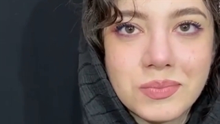 عمل بینی گوشتی با پوست ضخیم 5 ماه بعد از عمل | دکتر محمدعلی حسینی