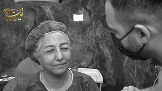 مراقبت های بعد از بلفاروپلاستی| دکتر سید علیرضا تولیت جراحی گوش