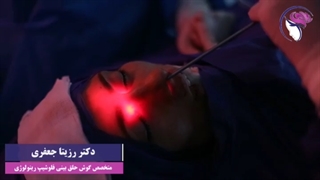 تخلیه دهانه سینوس ها با اندوسکوپی قبل از انجام عمل