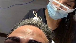 فیلم کاشت مو آقایان