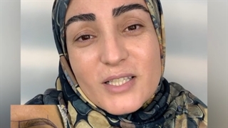 فیلم رضایت کاشت ابرو