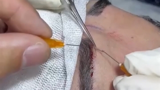 کارگاه کاشت مو و ابرو