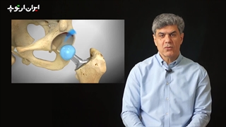 عمل جراحی تعویض مفصل لگن چه فایده ای دارد