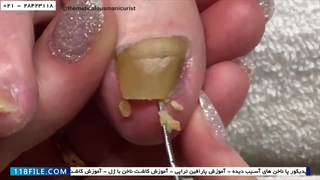 آموزش پدیکور-تکنیک های آموزش پدیکور-روش های جدید پدیکور-پیلینگ و لایه برداری