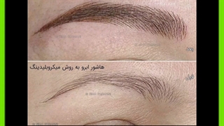 چرا کاشت ابرو به روی تاتو معجزه می کند؟