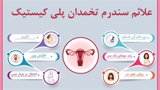 سندروم تخمدان پلی کیستیک چیست و چرا باعث ریزش مو می شود؟