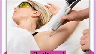 بهترین روش از بین بردن و حذف موهای زائد صورت و بدن خانگی و کلینیکی