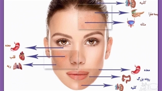جوش پریودی چیست؟ علل ایجاد، انواع و نحوه درمان آن ها