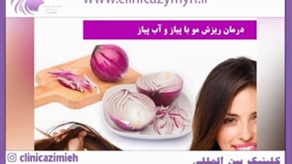 دلایل ریزش مو در زنان جوان و راهکارهای جلوگیری از آن