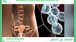 آیا عفونت رحم باعث ریزش مو می شود؟