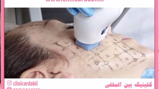 آر اف کونتراج