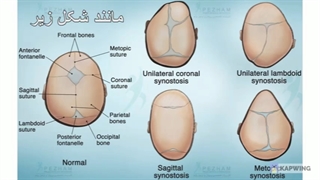 راهنمای کامل استفاده از کلاه فرم دهی سر نوزاد | کلینیک پژم