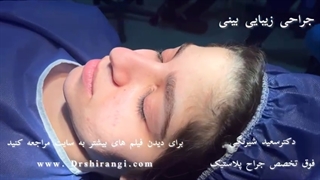 نمونه کار جراحی بینی دکتر سعید شیرنگی