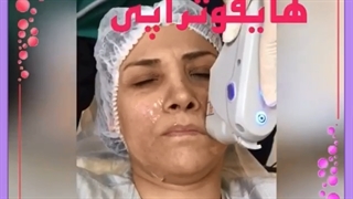 تصاویر هایفو تراپی صورت