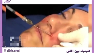 تزریق جوانسازی صورت رفع چین و چروک