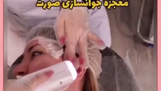 هایفو معجزه جوانسازی پوست صورت هزینه و مزایا