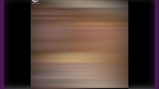 لیفت صورت