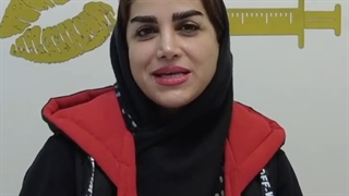 نمونه کار کاشت ابرو بعد از یکسال