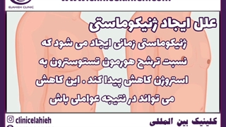 ژنیکوماستی