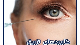 کاربردهای تزریق فیلر زیر چشم