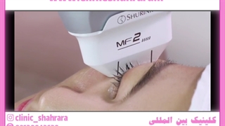 هایفوتراپی