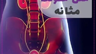 علل عفونت مثانه