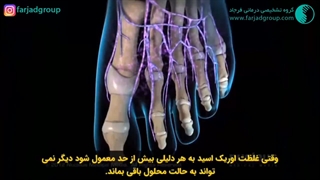 بیماری نقرس و درمان آن