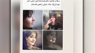 یک ماه بعد از جراحی بینی