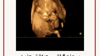 سونوگرافی حرکات جنین در شکم مادر