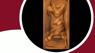 حرکات جنین در رحم مادر