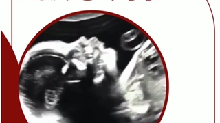 سونوگرافی جنین در شکم مادر