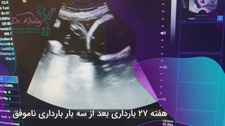 هفته 27 بارداری بعد از سه بارداری ناموفق